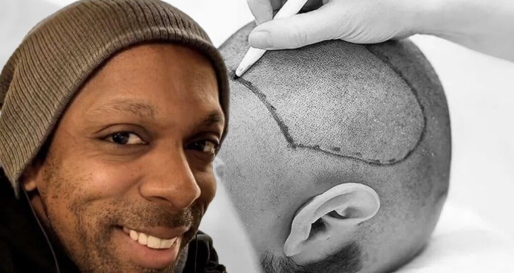 istanbulda yaptirdigi sac ekimi sonu oldu XjS12eGH