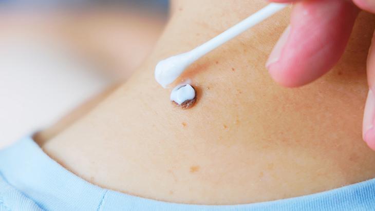 lazerle aldiran da var solusyon suren de her ben masum degil incelenmeli F1f7nna9.jpg